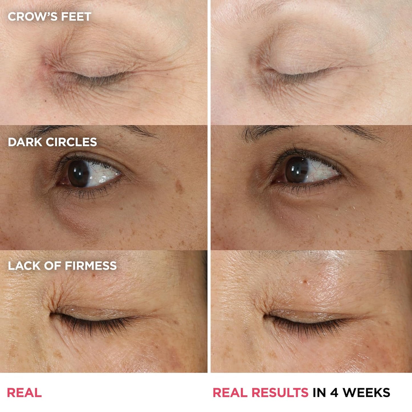 IT Cosmetics Confidence in an Eye Cream - Anti Aging Eye Cream for Dark Circles, Lightweight Formula Protects Skin Barrier, With 2% Super Peptide Concentrate, Fragrance-Free, For All Skin Types